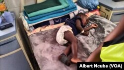 Baboon bites and snatches toddler in West Nicholson