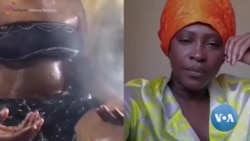Clareamento de Pele - Beleza ou Pressão Social