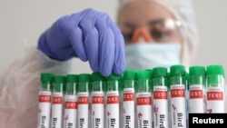FILE - Test tubes labelled 'Bird Flu", are seen in this picture illustration, Jan. 14, 2023. 
