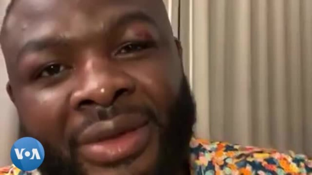 Martin Bakole abeti moyi Amerika Jared Anderson mpe abotoli ye nkama mibale na Los Angeles