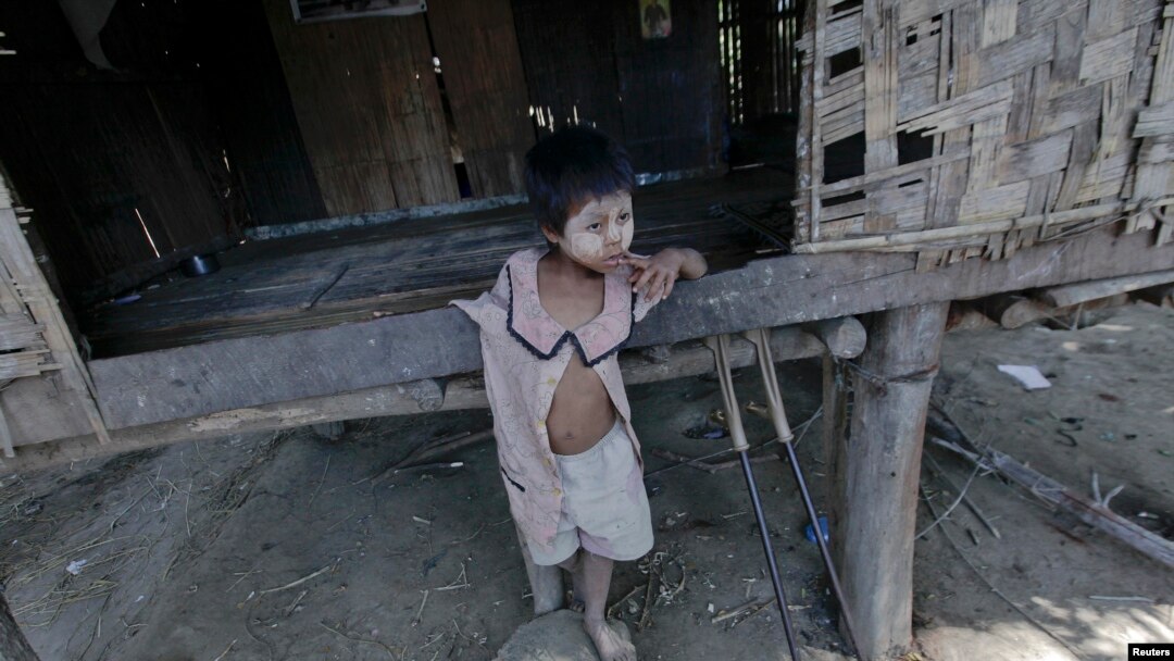 မြေမြှပ်မိုင်းဒဏ်ကြောင့်မသန်စွမ်းဖြစ်ခဲ့ရသူတဦးရဲ့အသက် ၅ နှစ်အရွယ်သမီးငယ်။