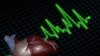 Study Links Mutations to APOC3 Gene with Dramatically Lower Risk for Heart Attack