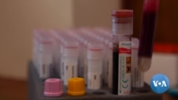 In South Africa, HIV's Patients Survive Disease But Are Weary of Its Toll
