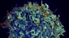 US says life-saving HIV treatment can continue during aid pause