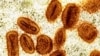 Health officials report first case of new form of mpox in US