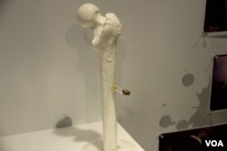 香港六四紀念館展出從六四學生活動人士張健腿部取出的子彈 。（美國之音記者申華拍攝）
