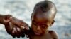FILE - A mother holds on to her emaciated infant at an emergency feeding clinic in Maradi, Niger.