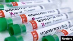 ILUSTRACIJA, ARHIVA - Pozitivni i ngativni uzorci testirani na virus majmunskih boginja (Foto: Reuters/Dado Ruvić)