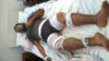 Jehad Mohamed, 25, set himself on fire using gasoline and a match outside the UNHCR office in Hargeisa, the capital of the self-declared republic of Somaliland, Oct. 6, 2015. (photo: B. Kariye)