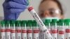 A test tube labelled "Mpox virus positive" is held in this illustration taken August 20, 2024. 