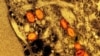 An undated colorized electron micrograph of mpox virus particles (red) found within an infected cell (brown) cultured in the laboratory, captured at the National Institute of Allergy and Infectious Diseases in Fort Detrick, Maryland. (NIAID via Reuters)