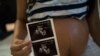 Aumentam casos de grávidas com zika em Cabo Verde